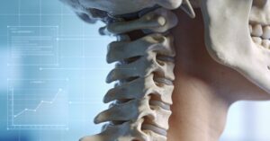 ICD-10 for neck pain: A Guide to Cervicalgia Coding and M54.2