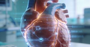 Coronary syndrome ICD-10: Understanding Acute Ischemic Heart Disease Codes
