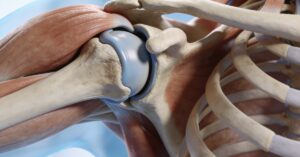 ICD-10 code shoulder pain: A Guide to Accurate Diagnosis Coding